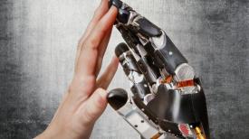 touch-sensitive artificial limb