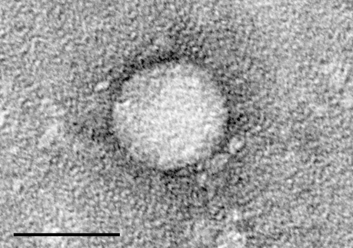 Electron Micrograph of HCV