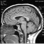 my brains - let me show you them