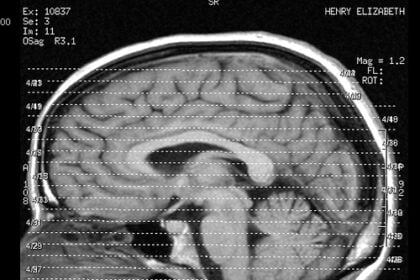 my brains - let me show you them