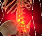  InVivo Therapeutics Protects And Regenerates The Spinal Cord Resulting in Functional Improvement Below the Injury