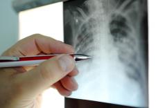 radiology healthcare IT