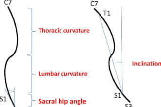 spinal posture