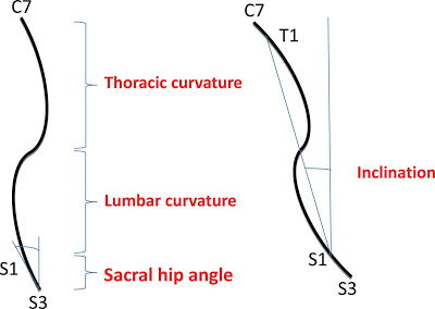 spinal posture