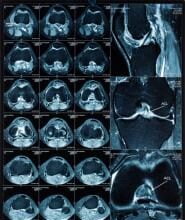 medical imaging and meaningful use