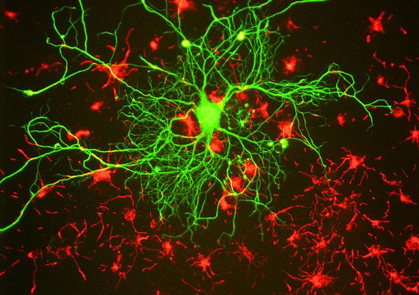 gene mutations and dementia