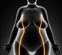 obesity recognized as disease