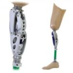bionic limbs