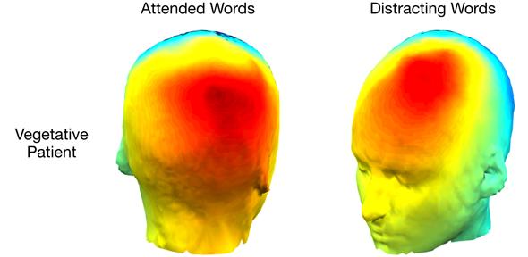 neurology research