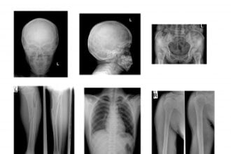 RSNA Image Project