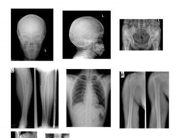 RSNA Image Project