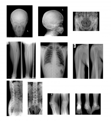 RSNA Image Project