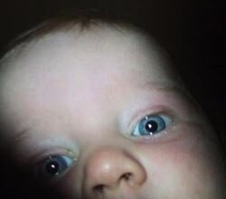 autism and language impairment