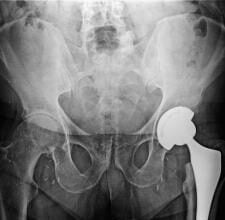 surgical processes