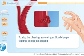 Emmi Solutions Instructional, Interactive Guide For Taking Warfarin