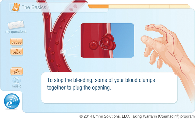 Emmi Solutions Instructional, Interactive Guide For Taking Warfarin