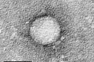 Electron Micrograph of HCV