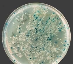bacteria