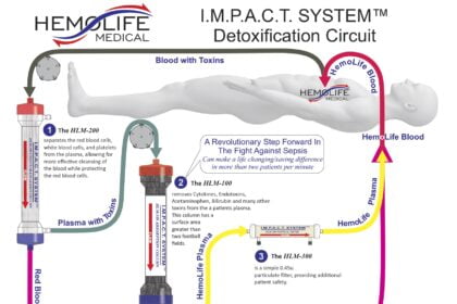 HemoLife IMPACT System