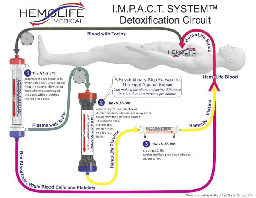 HemoLife IMPACT System