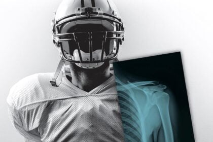 Carestream Sports Medicine