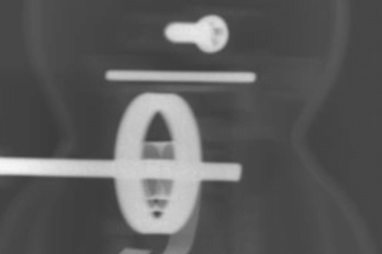 Carestream Image Challenge August 2015