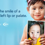 BHG Partner, Operation Smile