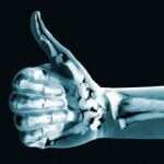 Thumb Up X-ray photo