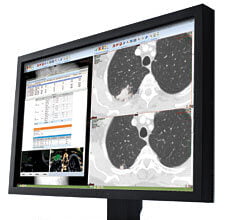 Carestream-clinical-collaboration-platform