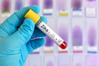 Zika Virus