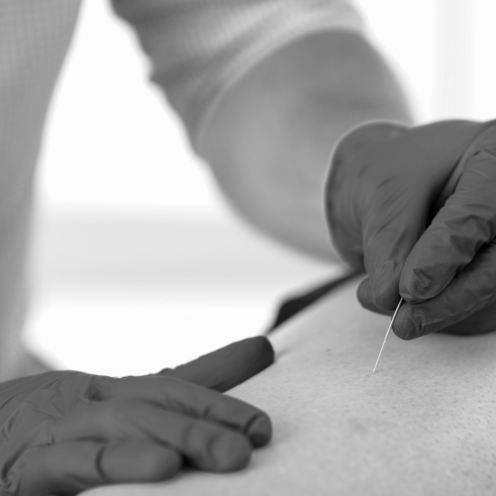 Dr Oz Claims Acupuncture Can Be Great For Weight Loss Dr Oz Claims Acupuncture Can Be Great For Weight Loss