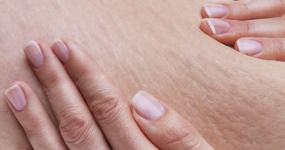 4 Symptoms of Collagen Deficiency After 50 Health Works Collective