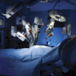 6 Benefits of Robotic Surgery