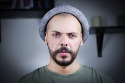 Psoriasis Patients Should Be Treated Prior To Hair Restoration Surgery