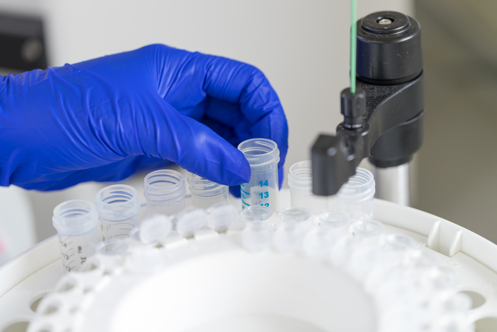 Methods for Protein Purification in Biotechnology Health Works Collective