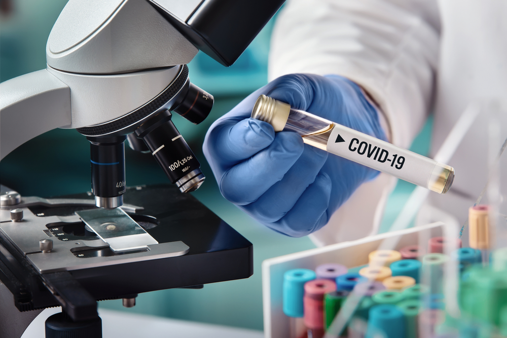  How Does The Coronavirus Test Work?
