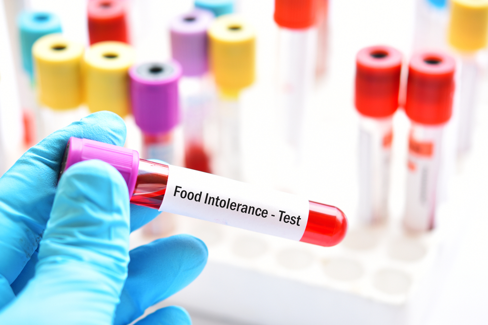  A Few Overlooked Benefits Of Food Sensitivity Testing