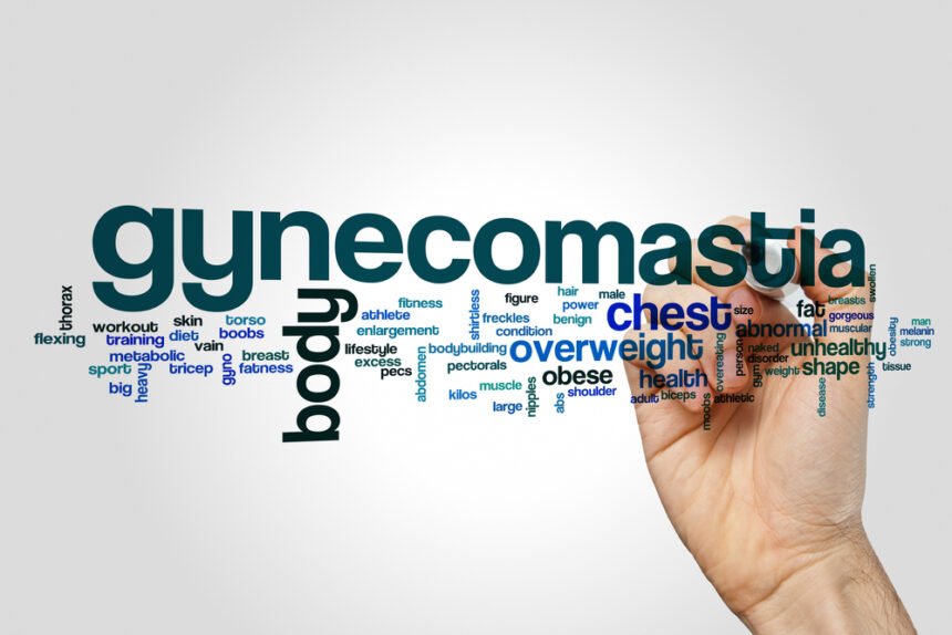 Gynecomastia