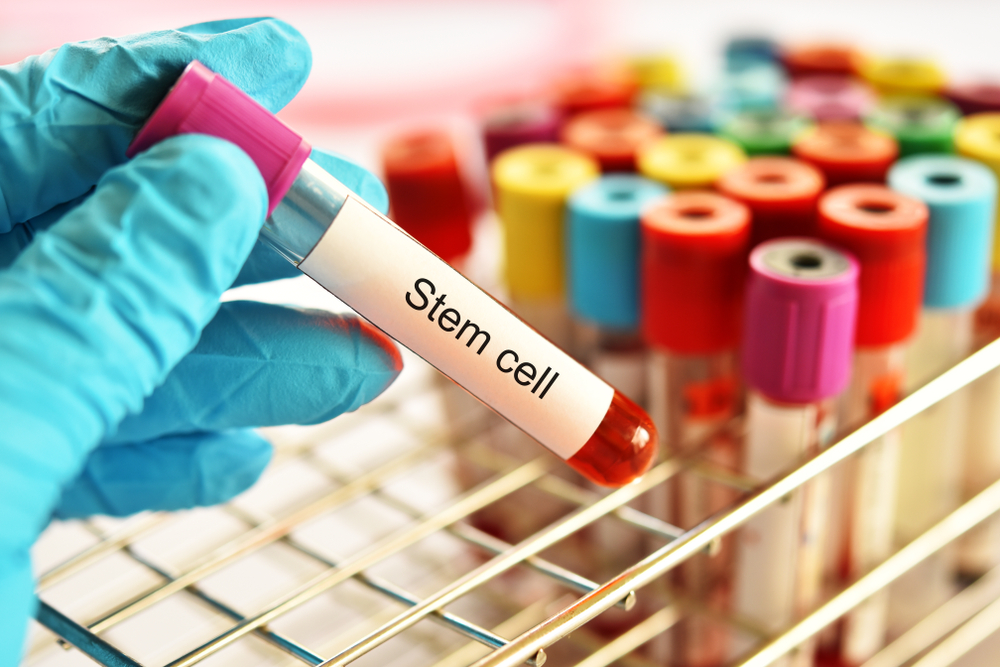 Lessons For Understanding The Cord Blood Transplant Process