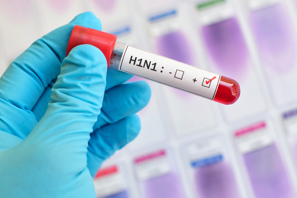  What We Know So Far About The New H1N1 Strain