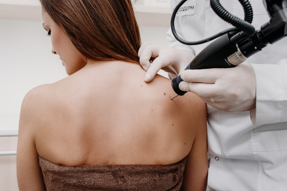 Mohs Micrographic Surgery: A History With Tim Ioannides M.D.