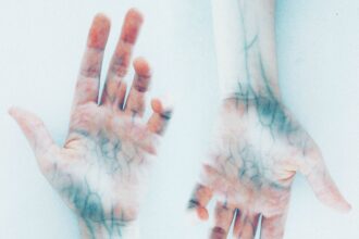 photo of hands with blue veins