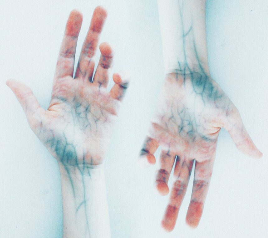 photo of hands with blue veins