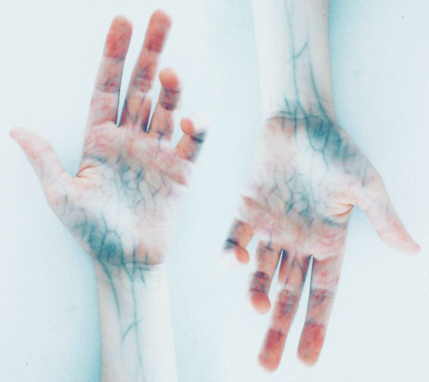 photo of hands with blue veins