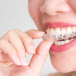 using invisalign to fix crooked teeth