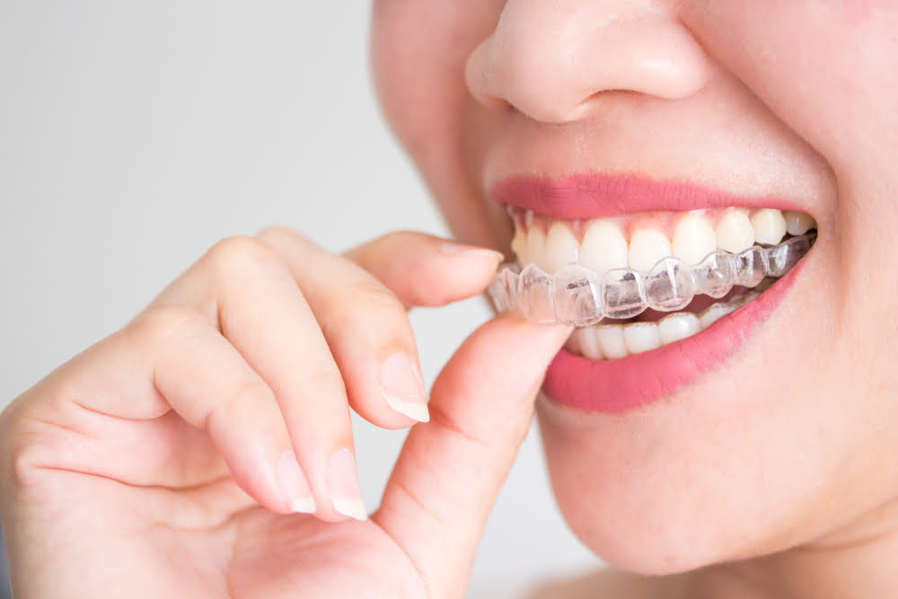 using invisalign to fix crooked teeth