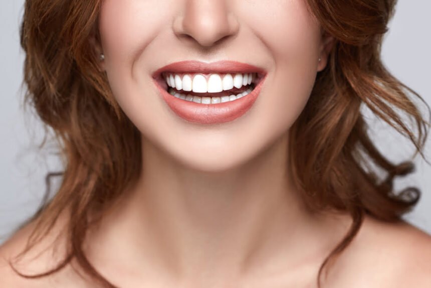 dental tips to give yourself beautiful white teeth