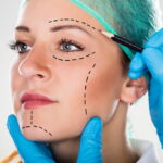 know your options when getting a facelift