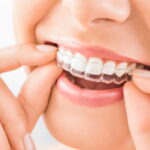 using Invisalign to deal with orthodontic problems