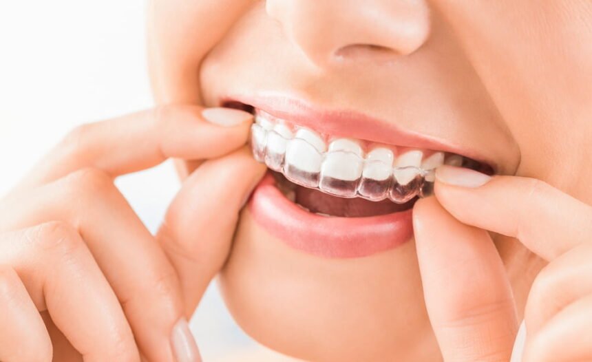 using Invisalign to deal with orthodontic problems